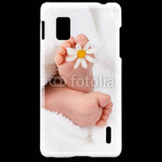 Coque LG Optimus G Pieds de bébé