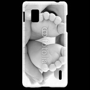 Coque LG Optimus G Pieds de bébé noir et blanc