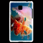 Coque LG Optimus L3 II Méduse géante et poissons