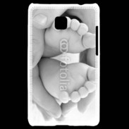 Coque LG Optimus L3 II Pieds de bébé noir et blanc