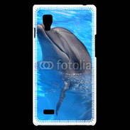 Coque LG Optimus L9 Dauphin 2