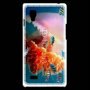 Coque LG Optimus L9 Méduse géante et poissons