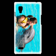 Coque LG Optimus L9 Bisou de dauphin