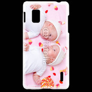 Coque LG Optimus G Jumeaux avec bonbons
