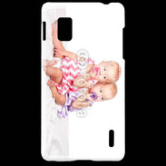 Coque LG Optimus G Duo de jumelles 2