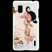 Coque LG Optimus G Duo bébé 2
