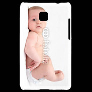 Coque LG Optimus L3 II Bébé allongé sur le dos