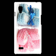 Coque LG Optimus L9 Chaussures bébé 3