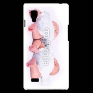 Coque LG Optimus L9 Jumeaux 8