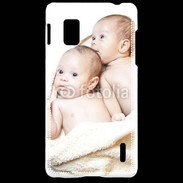 Coque LG Optimus G Jumeaux bébés