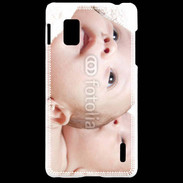 Coque LG Optimus G Têtes jumeaux