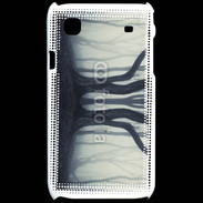 Coque Samsung Galaxy S Forêt frisson 6