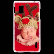 Coque LG Optimus G Bébé Rennes