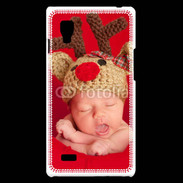 Coque LG Optimus L9 Bébé Rennes