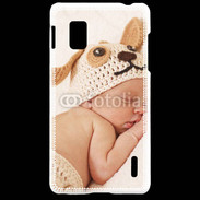 Coque LG Optimus G Bébé à la sieste 