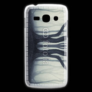 Coque Samsung Galaxy Ace3 Forêt frisson 6