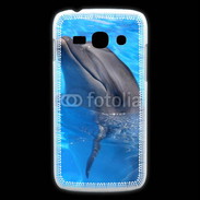 Coque Samsung Galaxy Ace3 Dauphin 2