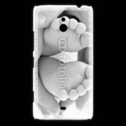 Coque Nokia Lumia 1320 Pieds de bébé noir et blanc