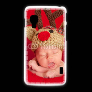 Coque LG L5 2 Bébé Rennes