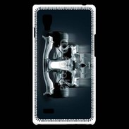 Coque LG Optimus L9 Formule 1 en dégradé