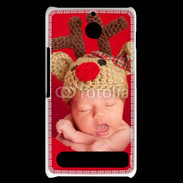 Coque Sony Xperia E1 Bébé Rennes