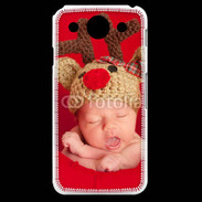 Coque LG G Pro Bébé Rennes