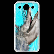Coque LG G Pro Dauphin 5