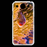 Coque LG G Pro Poisson tropical 15