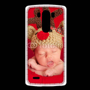 Coque LG G3 Bébé Rennes