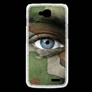 Coque LG L90 Militaire 3