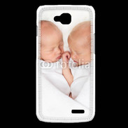 Coque LG L90 Duo de bébés qui dorment 2