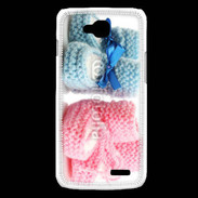 Coque LG L90 Chaussures bébé 3