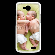 Coque LG L90 Jumeaux 5