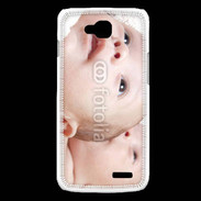 Coque LG L90 Têtes jumeaux