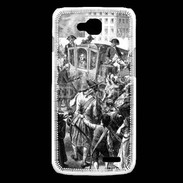 Coque LG L90 Louis XVI et la révolution française