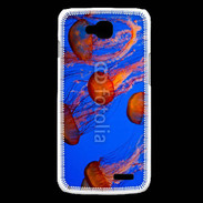 Coque LG L90 Bal de méduses