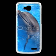 Coque LG L90 Dauphin 2