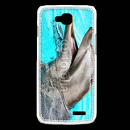 Coque LG L90 Dauphin 5