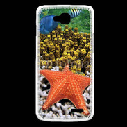 Coque LG L90 Etoile de mer