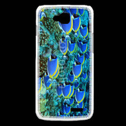 Coque LG L90 Banc de poissons bleus