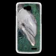 Coque LG L90 Tête de dauphin 1