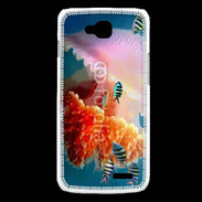 Coque LG L90 Méduse géante et poissons