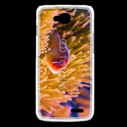 Coque LG L90 Poisson tropical 15