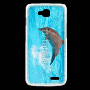 Coque LG L90 Dauphin 20