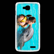 Coque LG L90 Bisou de dauphin