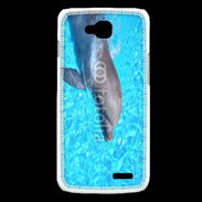 Coque LG L90 Dauphin 21
