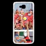 Coque LG L90 Beach volley 3