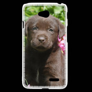 Coque LG L70 Chien labrador chocolat 3