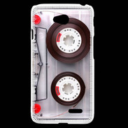 Coque LG L70 Cassette audio de musique