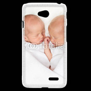 Coque LG L70 Duo de bébés qui dorment 2
